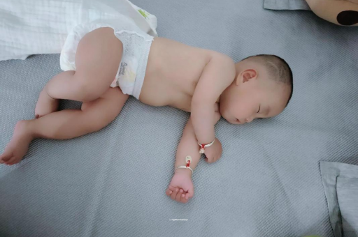 龙岩宝宝头上长痱子